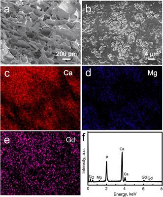 Gadolinium-doped whitlockite/chitosan composite scaffolds with osteogenic activity for bone defect treatment: In vitro and in vivo evaluations